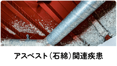 アスベスト（石綿）関連疾患